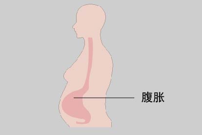 女性腹胀图片