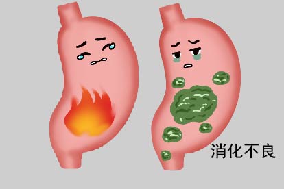 消化不良图片