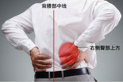 男性右后腰疼痛位置图