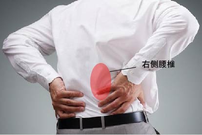 男性右侧腰部疼痛的位置图片