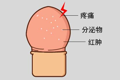 龟头炎图