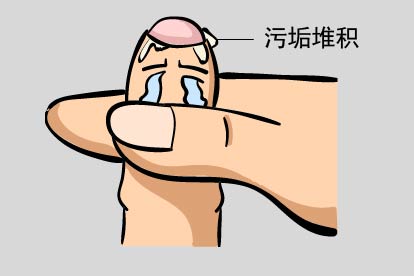 不注意卫生有小白点图