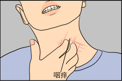 咽喉炎咽痒症状图片