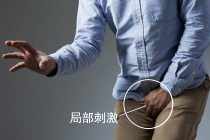 男性珍珠样阴茎丘疹局部刺激图