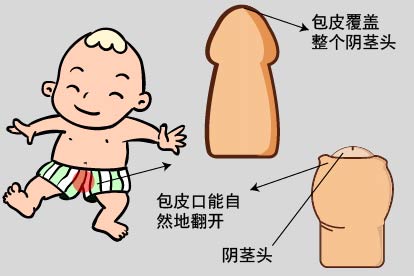 男童正常状态下包皮图片