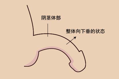 正常阴茎下垂图片