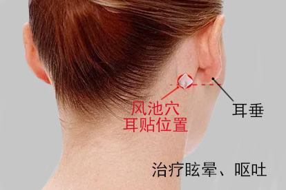 呕吐耳贴风池穴位置示意图