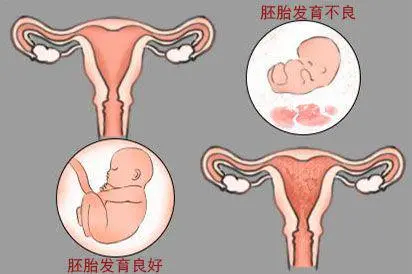 打过胎的子宫功能图片