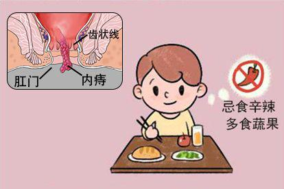 内痔脱出肛门外一般治疗图片