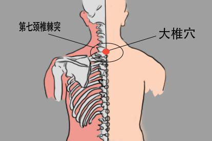 女性脊柱养生艾灸贴大椎穴位置图