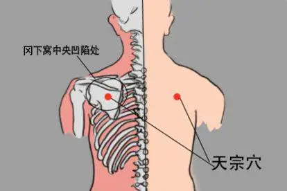女性脊柱养生艾灸贴天宗穴位置图