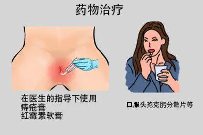 瘘疮药物治疗方法图片