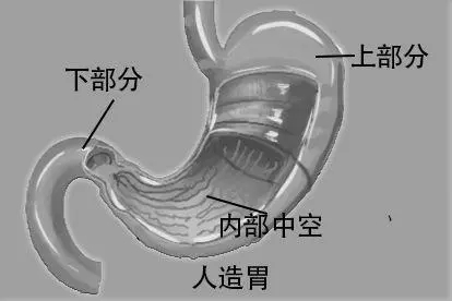 人造胃形状图片