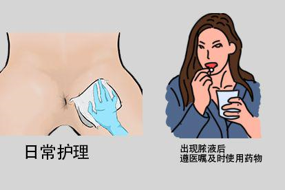 治疗方法图片