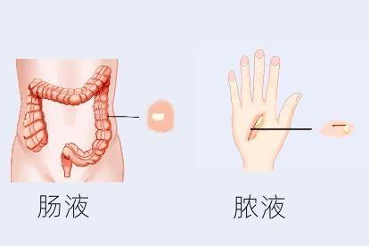 形成原因图片