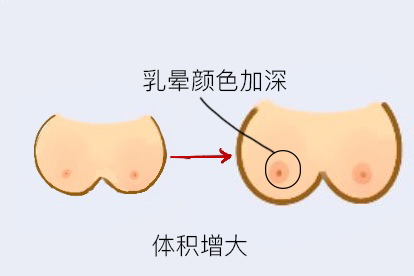 怀孕5个月乳房变化图片