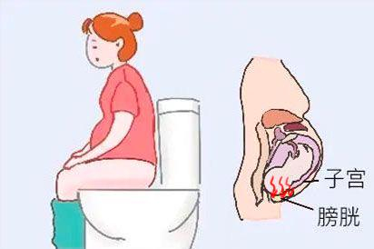 小便憋胀图片