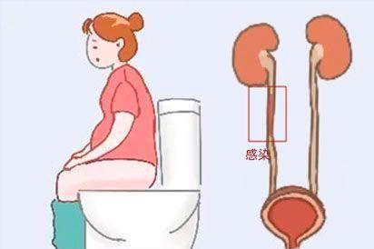 尿路感染图片