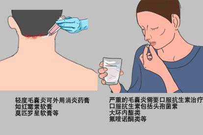 药物治疗图片