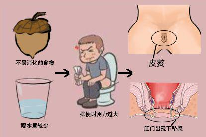 饮食不当图片