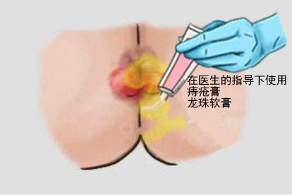 使用药物图片