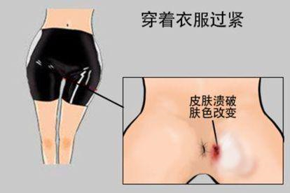 穿着衣服过紧图
