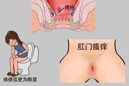 肛门瘙痒图