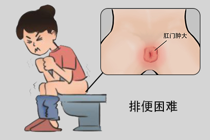 排便困难图