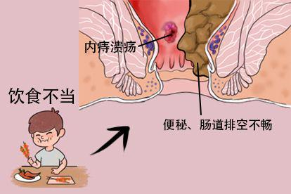 饮食不当图
