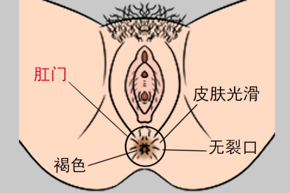 没有痔的肛门是怎么样的图片