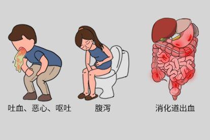 消化道出血