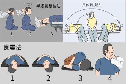 物理治疗图