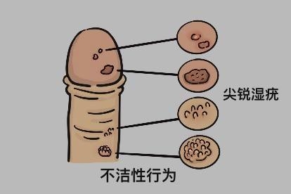 不洁性行为图