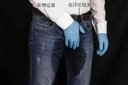 阴囊瘙痒是什么原因图片