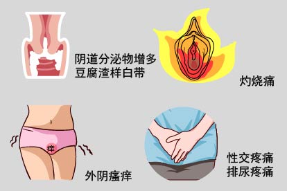 霉菌感染长小疙瘩图片