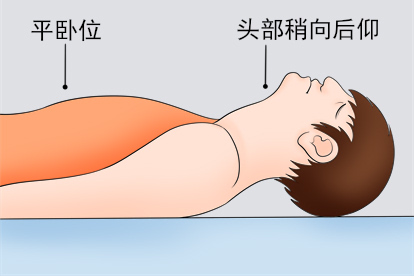 鼻饲管插管方法步骤二