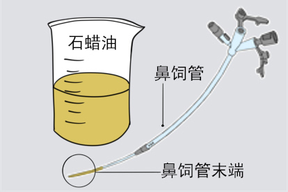 鼻饲管插管方法步骤一