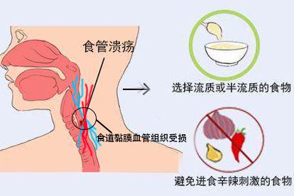 饮食调节图片