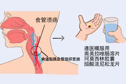 药物治疗图片