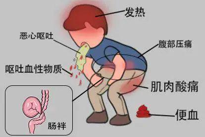 肠管扩张现象症状图片