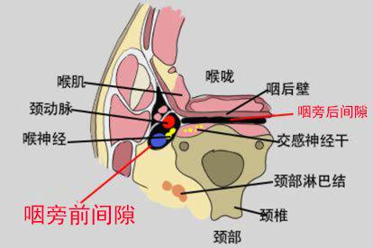 咽旁间隙位置图片