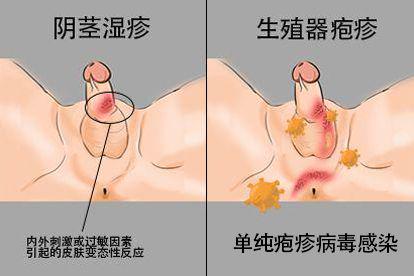 发病原因不同图