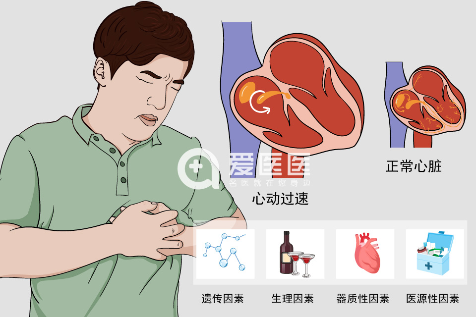 心动过速