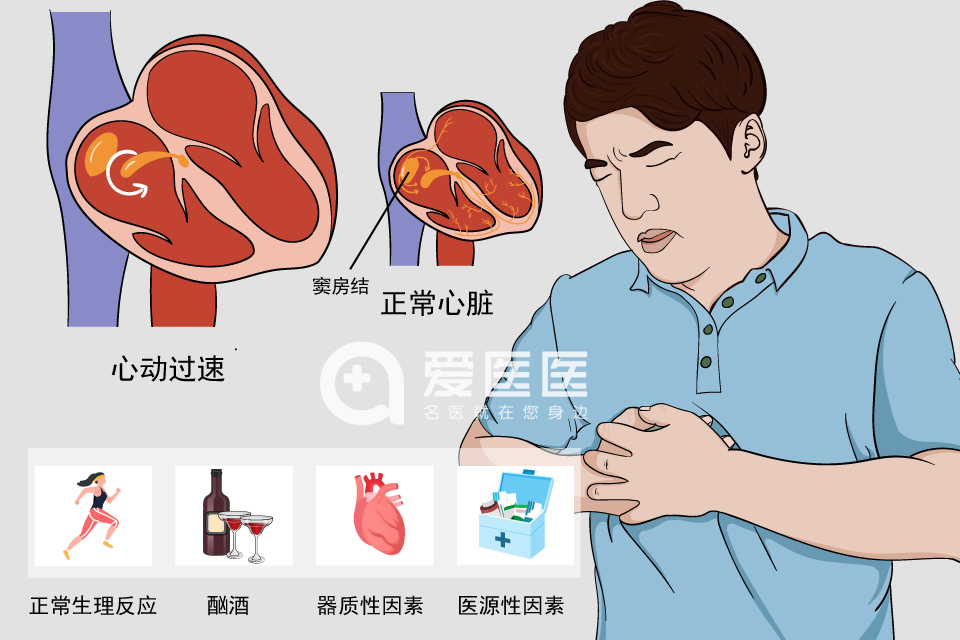 窦性心动过速