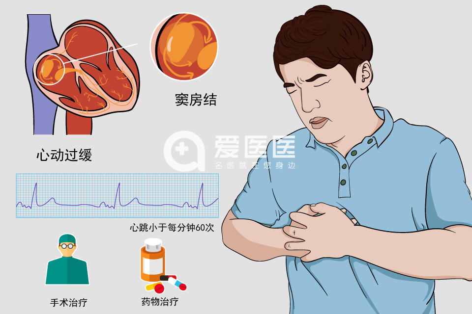 窦性心动过缓