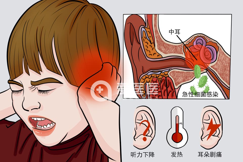急性中耳炎