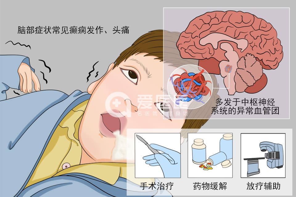 海绵状血管瘤