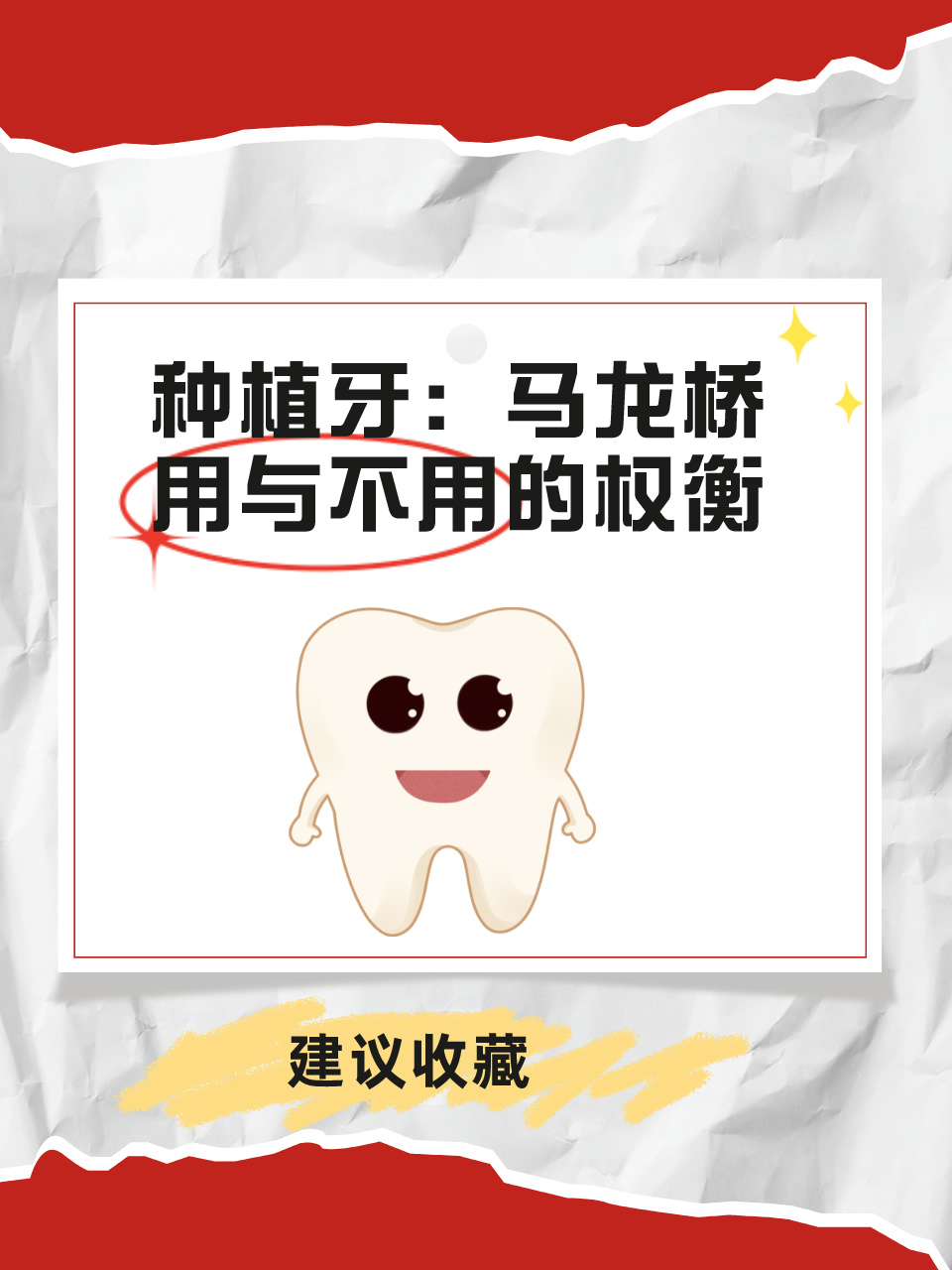 种植牙：马龙桥，用与不用的权衡