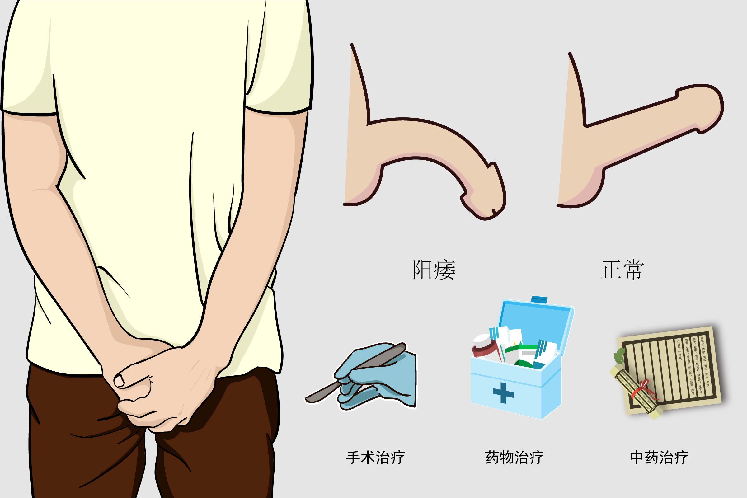 勃起困难