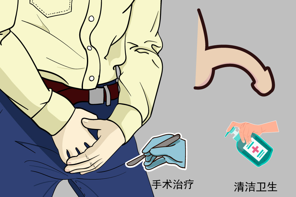龟头敏感